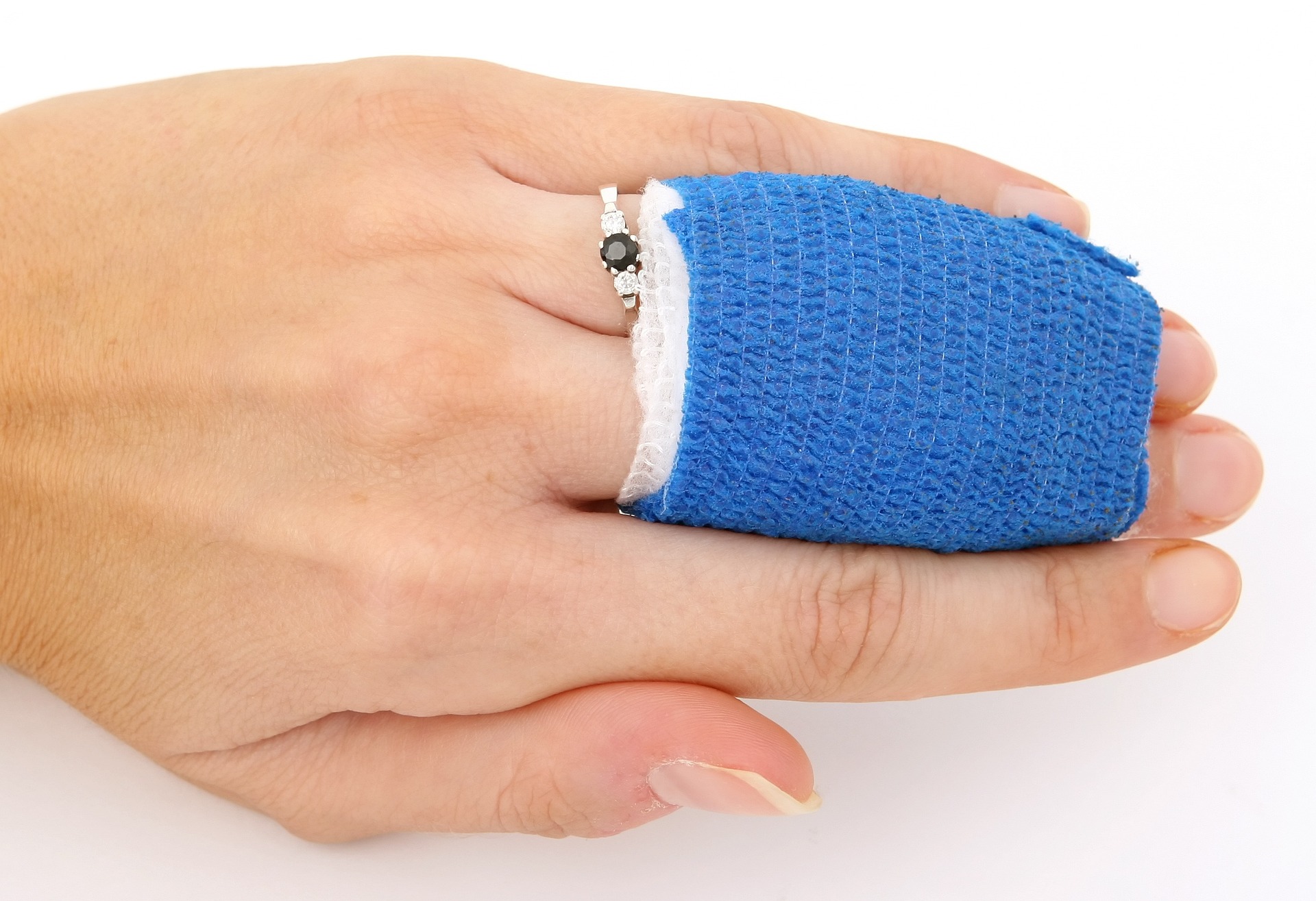 When to Seek Care for Burn Injuries