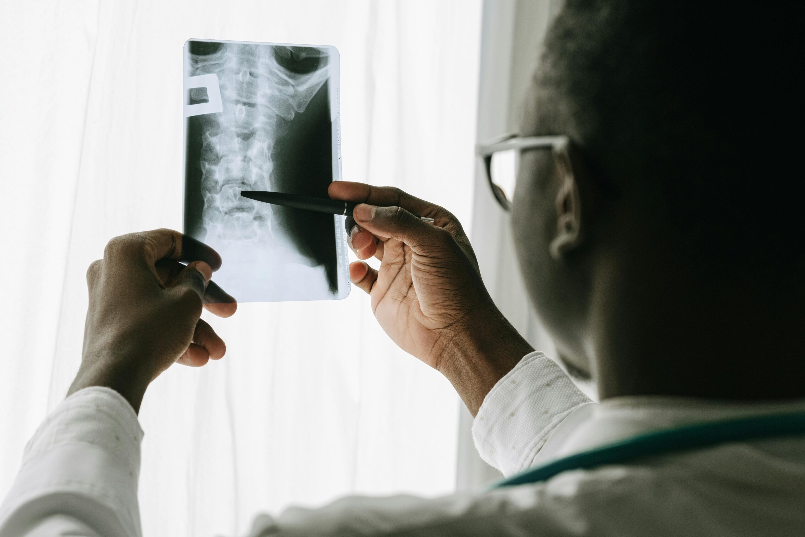 What You Should Know About Cervical Spinal Cord Injuries
