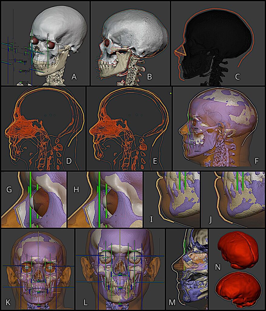 forensic reconstruction
