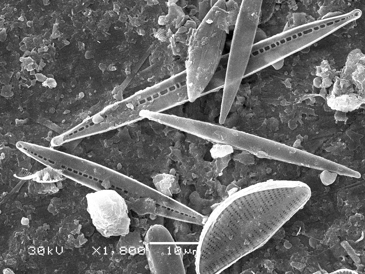Diatom