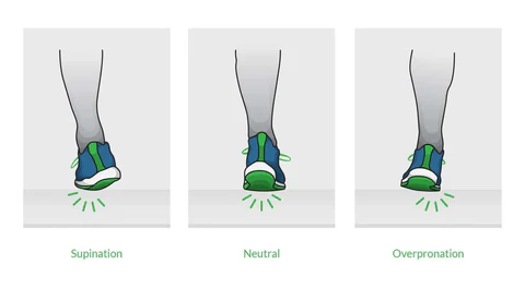 Gait analysis