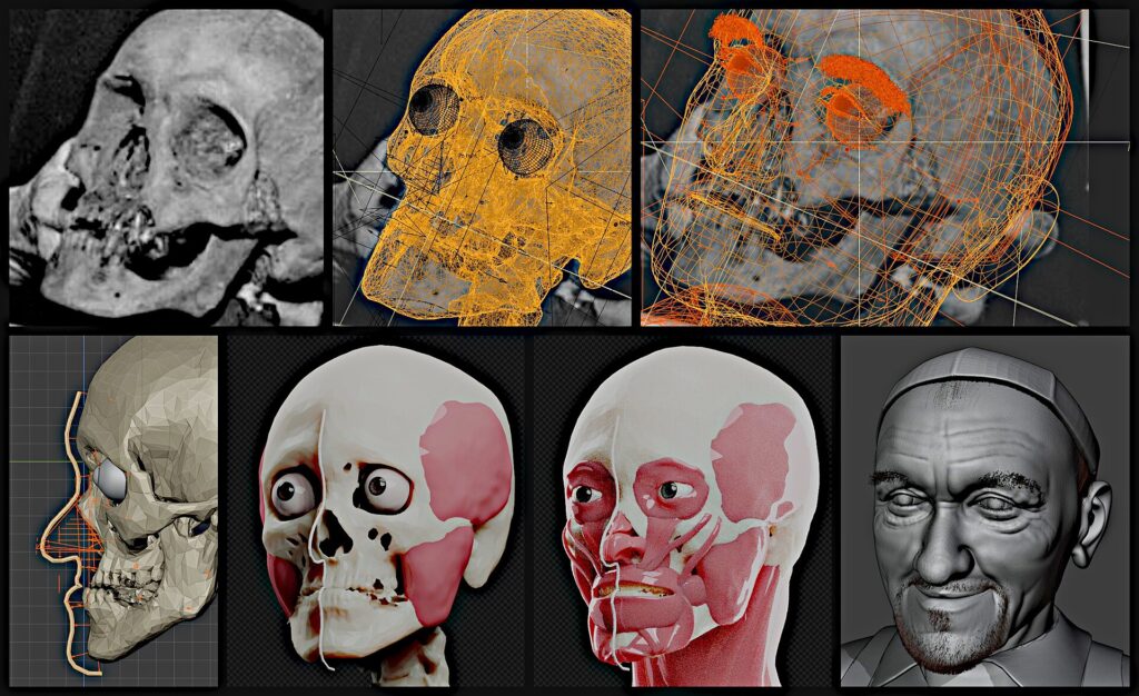 Facial reconstruction