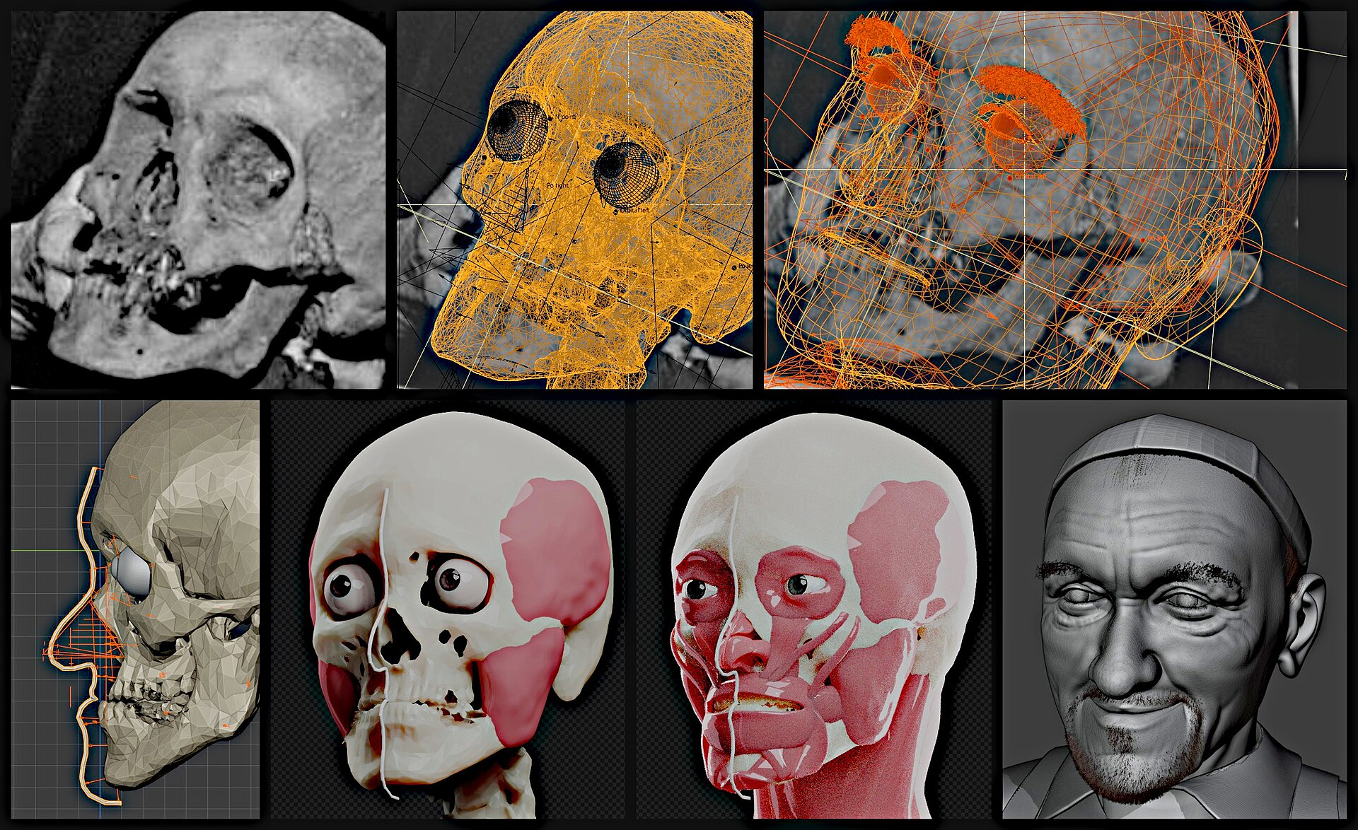 Facial reconstruction